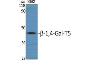 Western Blotting (WB) image for anti-UDP-Gal:betaGlcNAc beta 1,4- Galactosyltransferase, Polypeptide 5 (B4GALT5) (C-Term) antibody (ABIN3180961)