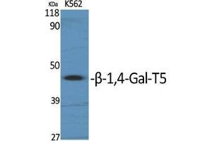 Western Blot (WB) analysis of specific cells using beta-1,4-Gal-T5 Polyclonal Antibody. (B4GALT5 Antikörper  (C-Term))