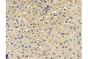 ABIN7095962 and ABIN7100024 at 1/100 staining mouse liver tissue by IHC-P. (AHCYL2 Antikörper)
