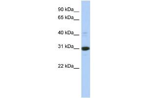 WB Suggested Anti-IMPA1 Antibody Titration: 0. (IMPA1 Antikörper  (Middle Region))