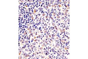(ABIN6243124 and ABIN6578087) staining DPYSL5 in human tonsil sections by Immunohistochemistry (IHC-P - paraformaldehyde-fixed, paraffin-embedded sections).