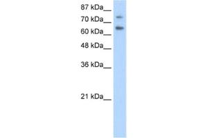 Western Blotting (WB) image for anti-Zinc Finger and SCAN Domain Containing 2 (ZSCAN2) antibody (ABIN2462016) (ZSCAN2 Antikörper)