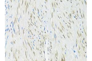 Immunohistochemistry of paraffin-embedded human uterus using RBFOX3 antibody (ABIN1874561) at dilution of 1:100 (40x lens). (NeuN Antikörper)