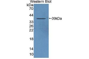 Western Blotting (WB) image for anti-Protein tyrosine Phosphatase, Non-Receptor Type 9 (PTPN9) (AA 289-593) antibody (ABIN5014228)