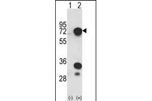 Western blot analysis of HNRPL (arrow) using rabbit polyclonal HNRPL Antibody (C-term) (ABIN650773 and ABIN2839553). (HNRNPL Antikörper  (C-Term))