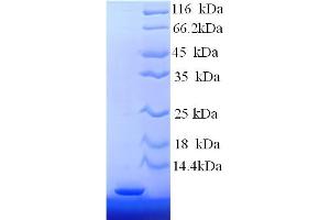 SDS-PAGE (SDS) image for Metallothionein 2A (MT2A) (AA 1-61) protein (His tag) (ABIN7478963)