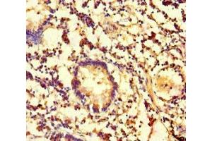 Immunohistochemistry of paraffin-embedded human appendix tissue using ABIN7146751 at dilution of 1:100 (CES3 Antikörper  (AA 65-233))