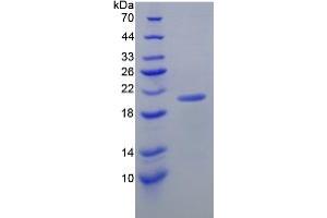 SDS-PAGE analysis of Mouse Interleukin 17C Protein. (IL17C Protein)