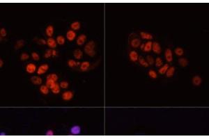Immunofluorescence analysis of MCF7 cells using Phospho-POLR2A(S5) Polyclonal Antibody at dilution of 1:100. (POLR2A/RPB1 Antikörper  (pSer5))