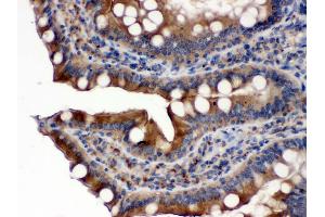 Immunohistochemistry (IHC) image for anti-P450 (Cytochrome) Oxidoreductase (POR) (AA 633-668), (C-Term) antibody (ABIN3043443)