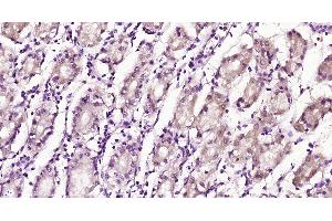 Immunohistochemistry (Paraffin-embedded Sections) (IHC (p)) image for anti-Leukocyte Immunoglobulin-Like Receptor, Subfamily B (With TM and ITIM Domains), Member 2 (LILRB2) (AA 1-100) antibody (ABIN1713554)