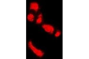 Immunofluorescent analysis of PADI4 staining in U2OS cells. (PAD4 Antikörper)