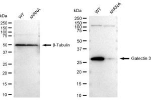 Western blotting analysis using Galectin 3 antibody (ABIN7798687). (Rekombinanter Galectin 3 Antikörper)