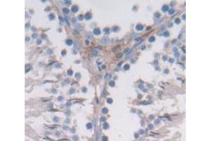 Used in DAB staining on fromalin fixed paraffin- embedded lung tissue (BCAR1 Antikörper  (AA 1-240))