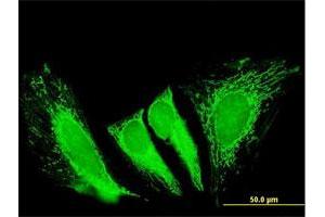 Immunofluorescence of purified MaxPab antibody to RTKN2 on HeLa cell. (RTKN2 Antikörper  (AA 1-163))