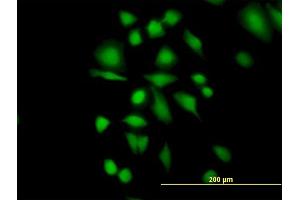 Immunofluorescence of purified MaxPab antibody to ETHE1 on HeLa cell.