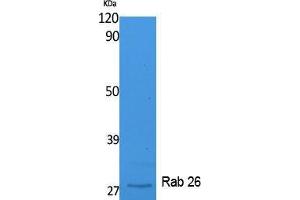 Western Blotting (WB) image for anti-RAB26, Member RAS Oncogene Family (RAB26) (C-Term) antibody (ABIN3178106) (RAB26 Antikörper  (C-Term))