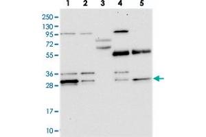 Western blot analysis of Lane 1: RT-4, Lane 2: U-251 MG, Lane 3: Human Plasma, Lane 4: Liver, Lane 5: Tonsil with PPTC7 polyclonal antibody  at 1:250-1:500 dilution. (PPTC7 Antikörper)