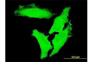 Immunofluorescence of monoclonal antibody to CHUK on HeLa cell. (IKK alpha Antikörper  (AA 646-745))