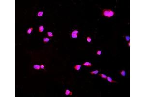 IF analysis of CTHRC1 using anti-CTHRC1 antibody (ABIN7601256). (CTHRC1 Antikörper  (AA 31-243))