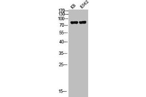Western Blot analysis of KB K562 cells using c-Myb Polyclonal Antibody (MYB Antikörper)