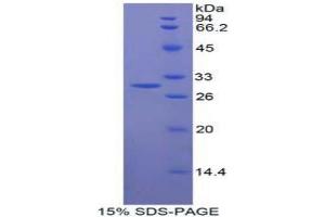SDS-PAGE analysis of Human MFNG Protein. (Manic Fringe Protein)