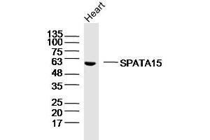 Mouse heart lysates probed with SPATA15/SPATC1 Polyclonal Antibody, Unconjugated  at 1:300 dilution and 4˚C overnight incubation. (SPATC1 Antikörper  (AA 1-100))