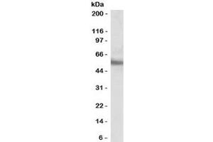 Western blot testing of human MOLT4 cell lysate with ERG antibody at 0. (ERG Antikörper)
