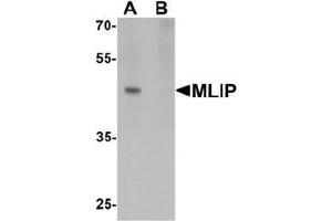 Western blot analysis of MLIP in 293 cell lysate with MLIP antibody at 1 ug/mL in (A) the absence and (B) the presence of blocking peptide. (MLIP Antikörper  (C-Term))