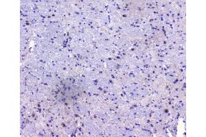 IHC analysis of PCDH15 using anti-PCDH15 antibody (ABIN6719362).