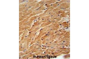 CCL21 Antibody (Center) immunohistochemistry analysis in formalin fixed and paraffin embedded mouse heart tissue followed by peroxidase conjugation of the secondary antibody and DAB staining. (CCL21 Antikörper  (Middle Region))