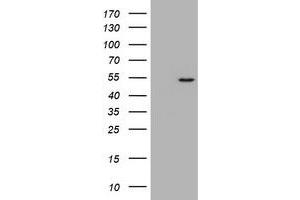 Image no. 1 for anti-Vimentin (VIM) (AA 210-466) antibody (ABIN1491207) (Vimentin Antikörper  (AA 210-466))