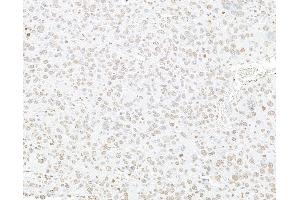 Immunohistochemistry (IHC) image for anti-Histone H3 (H3) (C-Term) antibody (ABIN7455227) (Histone 3 Antikörper  (C-Term))