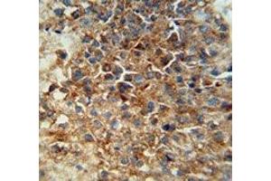 Immunohistochemistry (IHC) image for anti-CD46 (CD46) (AA 317-343) antibody (ABIN3030405)