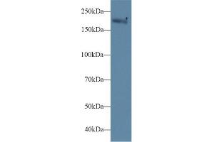 Detection of MYH1 in Mouse Serum using Polyclonal Antibody to Myosin Heavy Chain 1 (MYH1) (MYH1 Antikörper  (AA 1585-1642))