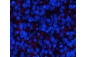 Immunofluorescence analysis of Rat spleen tissue using ERK 1 Monoclonal Antibody at dilution of 1:200. (ERK1 Antikörper)