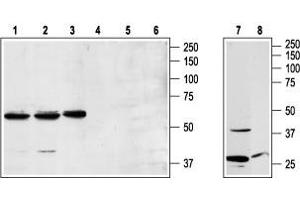 Western blot analysis of Jurkat (lanes 1 and 4), K562 (lanes 2 and 5), and RBL (lanes 3 and 6) cell lysates and rat brain lysates (lanes 7 and 8): - 1,2,3,7. (NPY1R Antikörper  (3rd Intracellular Loop))