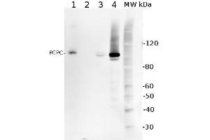 5ug of total protein from (1) Arabidopsis thaliana leaf extracted with Protein ExtrationBuffer, PEB , (2) Spinacia oleracea total cell, extracted with PEB, (3)Hordeum vulgare total cell extracted with PEB, (4) Zea mays total cell extracted withPEB, were separated on 4-12% NuPage (Invitrogen) LDS-PAGE and blotted 1h toPVDF. (PCK1 Antikörper)