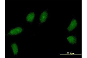 Immunofluorescence of purified MaxPab antibody to C1orf83 on HeLa cell. (TCEANC2 Antikörper  (AA 1-208))