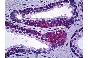Anti-PPP3CC antibody IHC of human prostate. (PPP3CC Antikörper  (N-Term))
