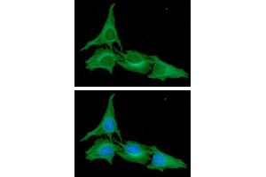 ICC/IF analysis of ATG3 in HeLa cells. (ATG3 Antikörper  (AA 1-314))