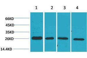 Western Blotting (WB) image for anti-SLUG antibody (ABIN3181521) (SLUG Antikörper)