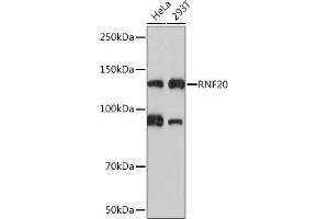 Western blot analysis of extracts of various cell lines, using RNF20 Rabbit mAb (ABIN7270071) at 1:1000 dilution. (RNF20 Antikörper)
