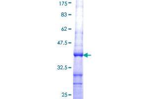 Image no. 1 for Coproporphyrinogen Oxidase (CPOX) (AA 356-453) protein (GST tag) (ABIN1350225) (CPOX Protein (AA 356-453) (GST tag))