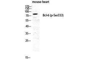 Western Blotting (WB) image for anti-B-Cell CLL/lymphoma 6 (BCL6) (pSer333) antibody (ABIN3173113) (BCL6 Antikörper  (pSer333))
