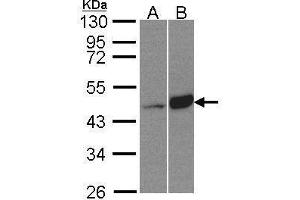 WB Image Sample(30 μg of whole cell lysate) A:HeLa S3, B:Raji, 10% SDS PAGE antibody diluted at 1:500 (BCKDK Antikörper)