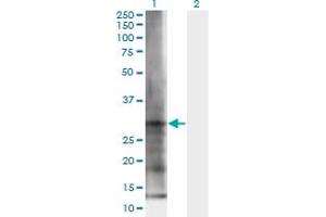 Western Blot analysis of ELA3B expression in transfected 293T cell line by ELA3B monoclonal antibody (M06), clone 3H3.