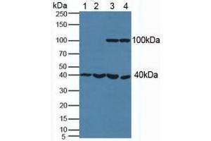 Figure. (PSAT1 Antikörper  (AA 1-312))