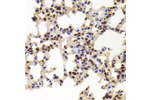 Immunohistochemistry of paraffin-embedded Mouse lung using PPAT antibody at dilution of 1:100 (x400 lens). (PPAT Antikörper)