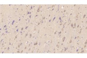 Detection of NT-ProBNP in Human Cerebrum Tissue using Monoclonal Antibody to N-Terminal Pro-Brain Natriuretic Peptide (NT-ProBNP) (NT-ProBNP Antikörper)